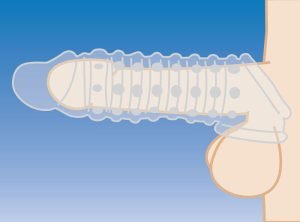 Illustration of a male anatomical structure with a focus on detail